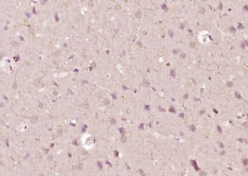 LPPR1 Polyclonal Antibody
