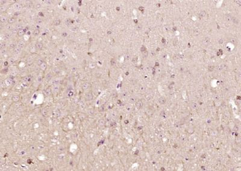 LPPR1 Polyclonal Antibody