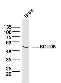 KCTD8 Polyclonal Antibody