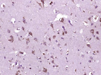 P2Y9 Polyclonal Antibody