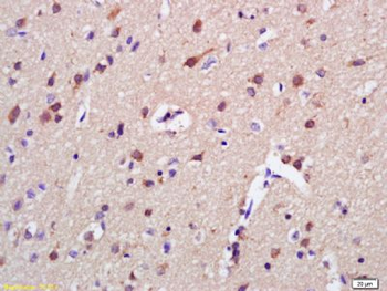 AKAP7 Polyclonal Antibody