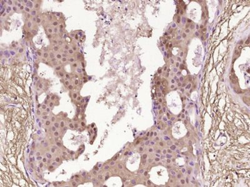 AKAP7 Polyclonal Antibody