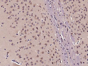 Semaphorin 3D Polyclonal Antibody