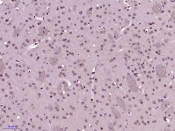 SOX21 Polyclonal Antibody
