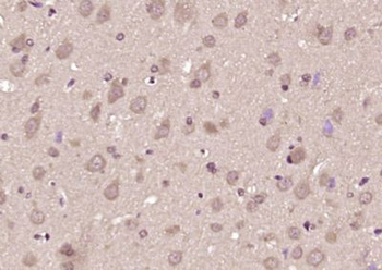 GEFT Polyclonal Antibody