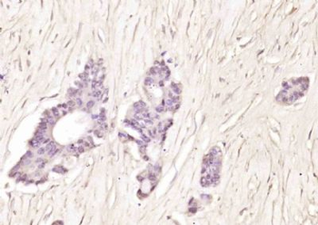 DNTNP Polyclonal Antibody