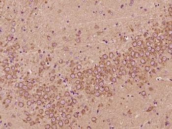 ZFYVE27 Polyclonal Antibody
