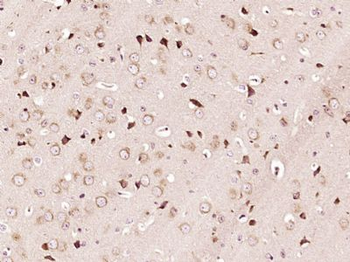 ZFYVE27 Polyclonal Antibody