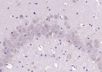 ELAVL2 + ELAVL4 Polyclonal Antibody