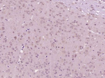 Senataxin Polyclonal Antibody