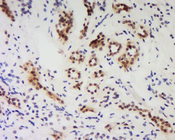 PPP1R10 Polyclonal Antibody