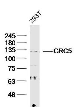 GRC5 Polyclonal Antibody