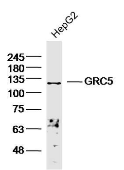 GRC5 Polyclonal Antibody