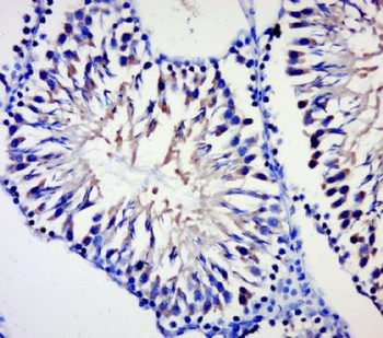 BPTF Polyclonal Antibody