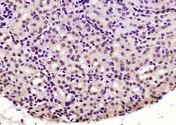 BPTF Polyclonal Antibody