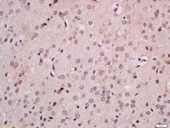 FOXB1 Polyclonal Antibody