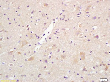 Centaurin alpha 1 Polyclonal Antibody