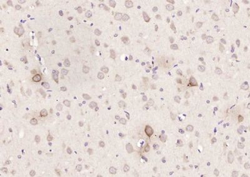 SORCS3 Polyclonal Antibody