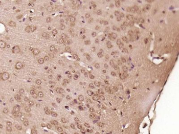 SPAG16 Polyclonal Antibody