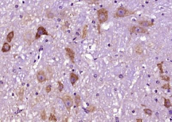 Syntaxin 13 Polyclonal Antibody
