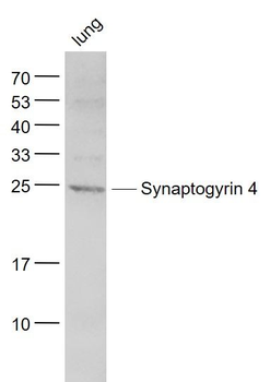 Synaptogyrin 4 Polyclonal Antibody