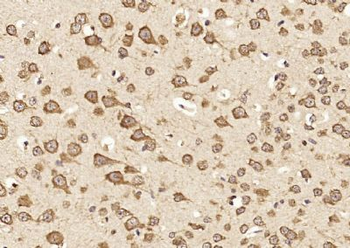 Munc13 Polyclonal Antibody