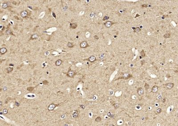 KIF1A Polyclonal Antibody