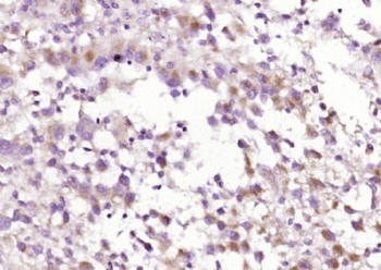 C1QC Polyclonal Antibody