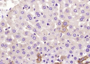 C1QC Polyclonal Antibody