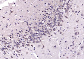PCP4 Polyclonal Antibody