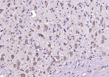 PCP4 Polyclonal Antibody