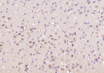 ELAVL4 Polyclonal Antibody