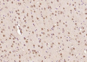 Ataxin 7 Polyclonal Antibody