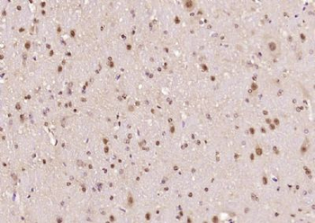 Ataxin 7 Polyclonal Antibody