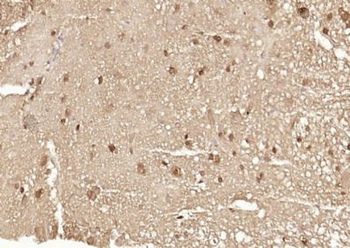 Ataxin 7 Polyclonal Antibody