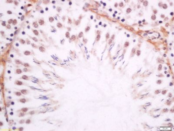 Dmrta1 Polyclonal Antibody