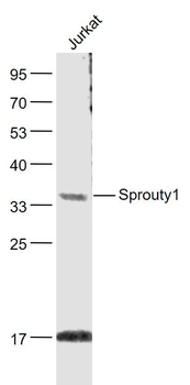 Sprouty1 Polyclonal Antibody