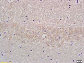 VGLUT1/BNP1 Polyclonal Antibody
