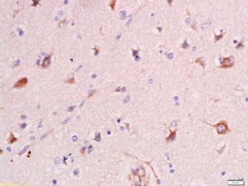 VGLUT1/BNP1 Polyclonal Antibody