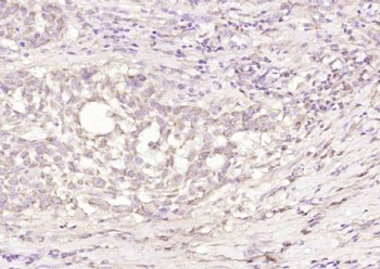 SPRR3 Polyclonal Antibody