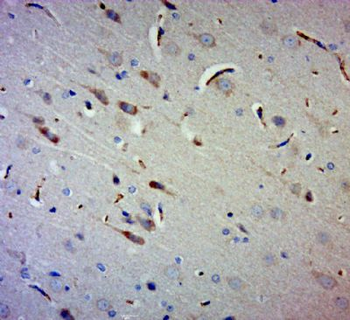 Gigaxonin Polyclonal Antibody