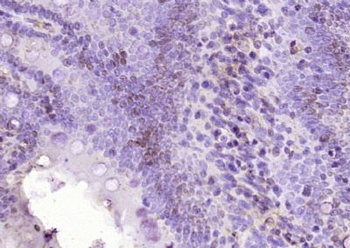 FAM84A Polyclonal Antibody