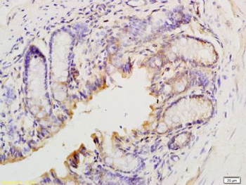 T Beta 10 Polyclonal Antibody
