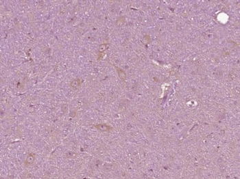 Robo3 Polyclonal Antibody