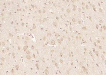 RRAGA + RRAGB Polyclonal Antibody