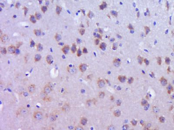 DYNC1I2 Polyclonal Antibody