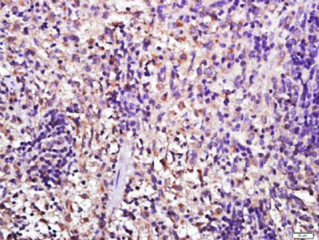 Galectin 3 Polyclonal Antibody