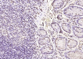 Galectin 3 Polyclonal Antibody