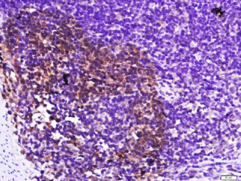 Galectin 3 Polyclonal Antibody