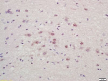 Bassoon Polyclonal Antibody